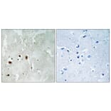 Immunohistochemistry - Anti-Tip60 (phospho Ser90) Antibody (A8434) - Antibodies.com