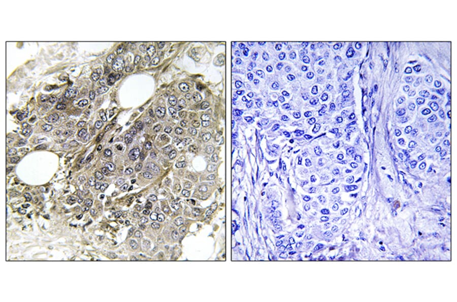 Immunohistochemistry - Anti-TGF beta Receptor III Antibody (B1128) - Antibodies.com