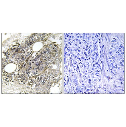 Immunohistochemistry - Anti-TGF beta Receptor III Antibody (B1128) - Antibodies.com