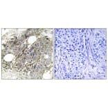 Immunohistochemistry - Anti-TGF beta Receptor III Antibody (B1128) - Antibodies.com