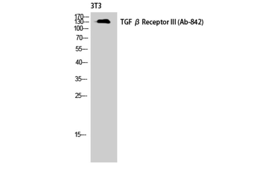 Western Blot - Anti-TGF beta Receptor III Antibody (B1128) - Antibodies.com