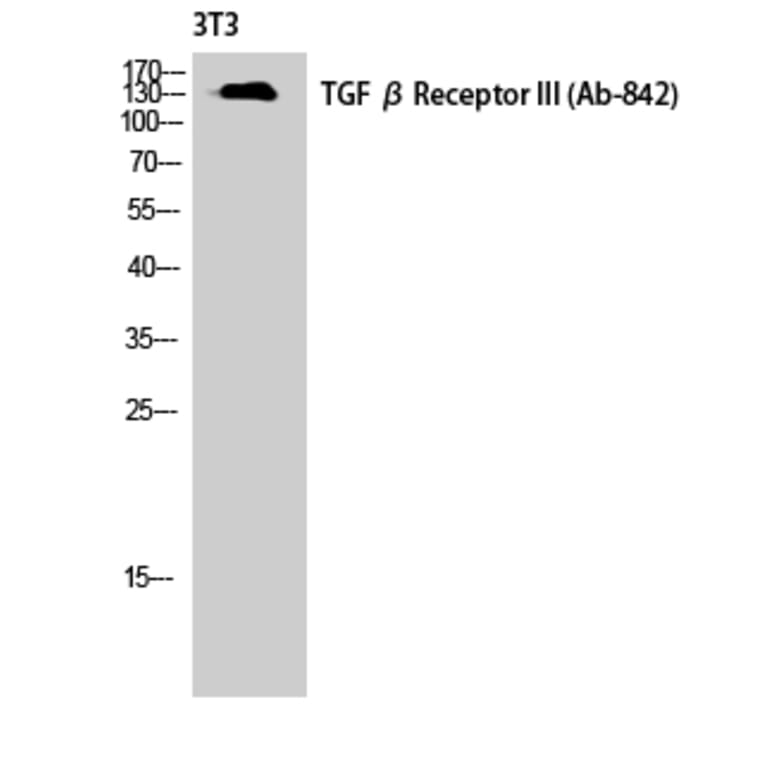 Western Blot - Anti-TGF beta Receptor III Antibody (B1128) - Antibodies.com