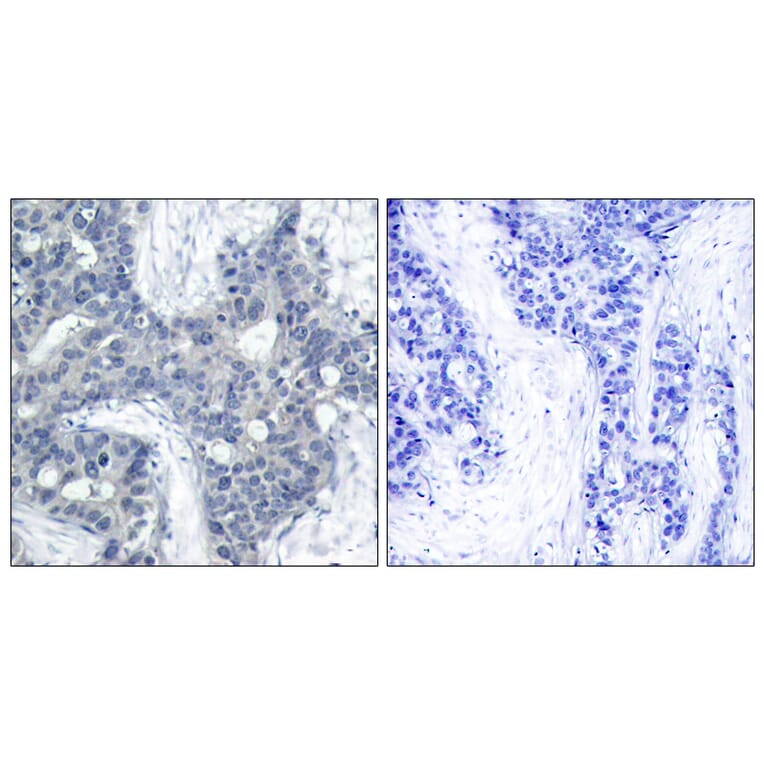 Immunohistochemistry - Anti-PYK2 (phospho Tyr402) Antibody (A7204) - Antibodies.com