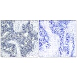 Immunohistochemistry - Anti-PYK2 (phospho Tyr402) Antibody (A7204) - Antibodies.com