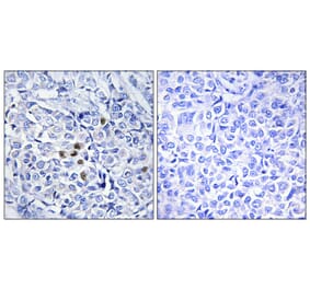 Immunohistochemistry - Anti-PLK1 (phospho Thr210) Antibody (A0554) - Antibodies.com
