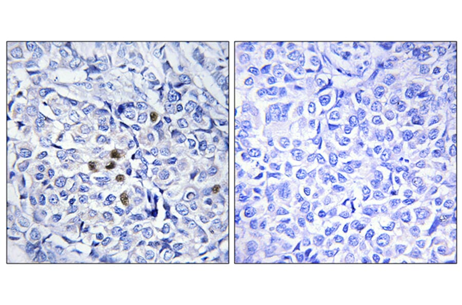 Immunohistochemistry - Anti-PLK1 (phospho Thr210) Antibody (A0554) - Antibodies.com