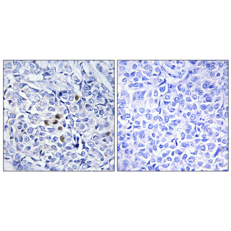 Immunohistochemistry - Anti-PLK1 (phospho Thr210) Antibody (A0554) - Antibodies.com