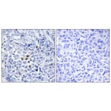 Immunohistochemistry - Anti-PLK1 (phospho Thr210) Antibody (A0554) - Antibodies.com