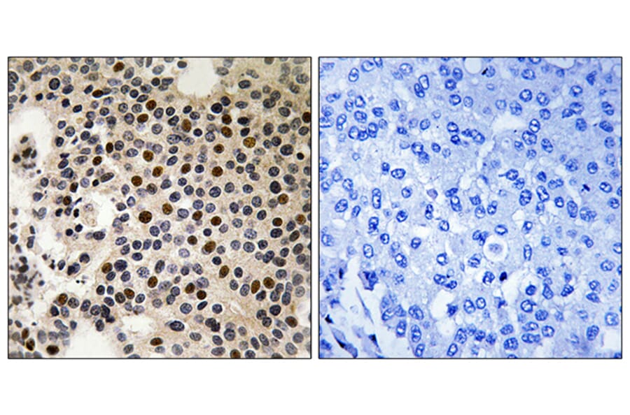 Immunohistochemistry - Anti-PAK2 (phospho Ser197) Antibody (A8162) - Antibodies.com