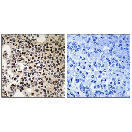Immunohistochemistry - Anti-PAK2 (phospho Ser197) Antibody (A8162) - Antibodies.com