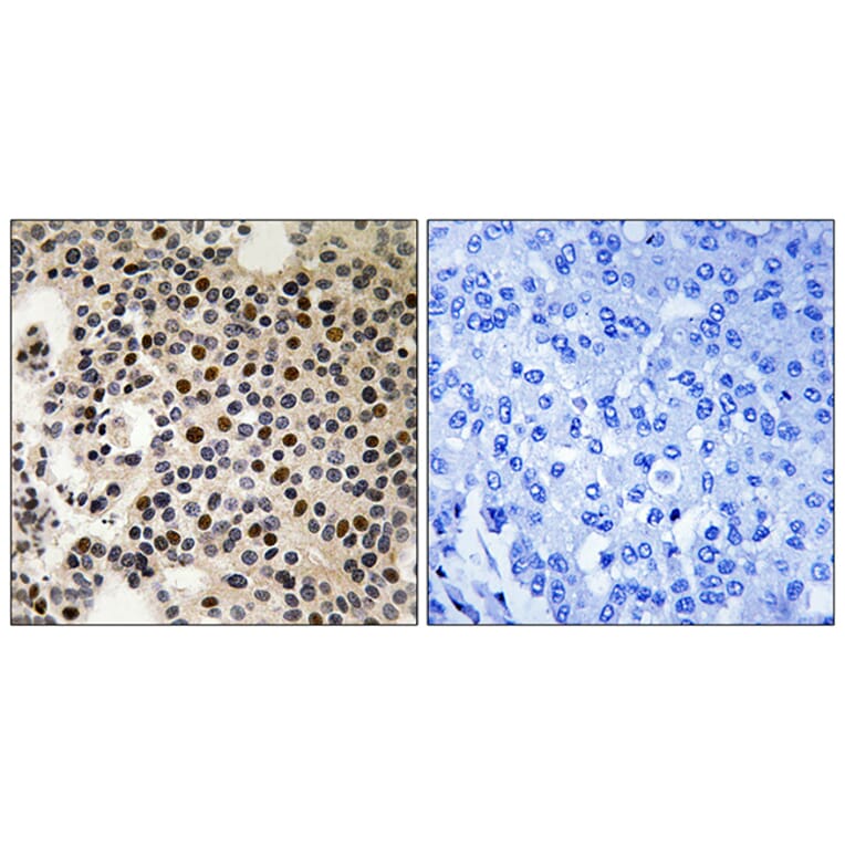 Immunohistochemistry - Anti-PAK2 (phospho Ser197) Antibody (A8162) - Antibodies.com