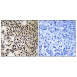 Immunohistochemistry - Anti-PAK2 (phospho Ser197) Antibody (A8162) - Antibodies.com