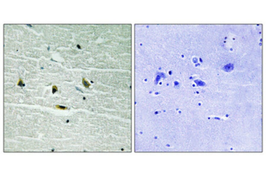 Immunohistochemistry - Anti-JAK2 (phospho Tyr119) Antibody (A8119) - Antibodies.com