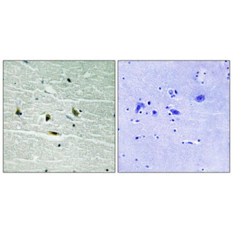 Immunohistochemistry - Anti-JAK2 (phospho Tyr119) Antibody (A8119) - Antibodies.com