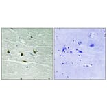 Immunohistochemistry - Anti-JAK2 (phospho Tyr119) Antibody (A8119) - Antibodies.com