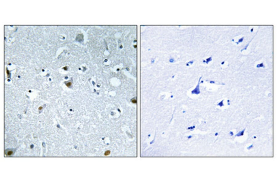 Immunohistochemistry - Anti-HMG17 (phospho Ser29) Antibody (A1039) - Antibodies.com