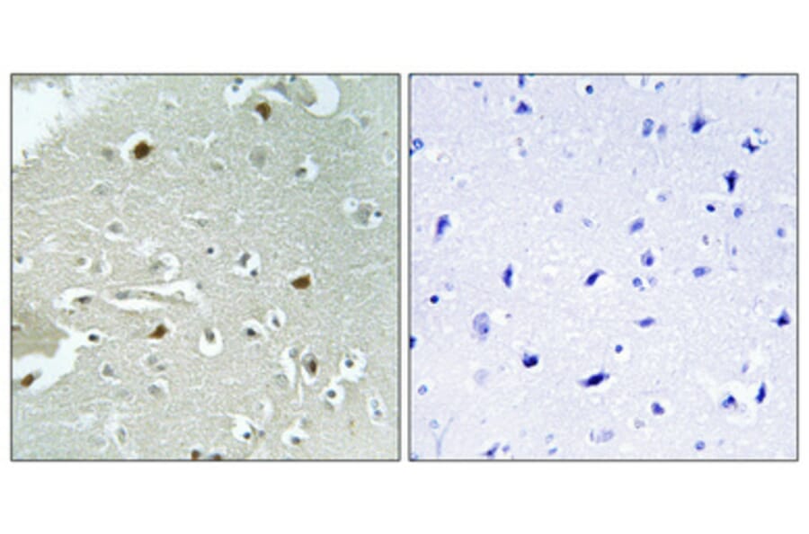 Immunohistochemistry - Anti-HAND1 (phospho Ser98) Antibody (A1034) - Antibodies.com