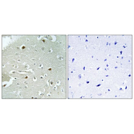 Immunohistochemistry - Anti-HAND1 (phospho Ser98) Antibody (A1034) - Antibodies.com