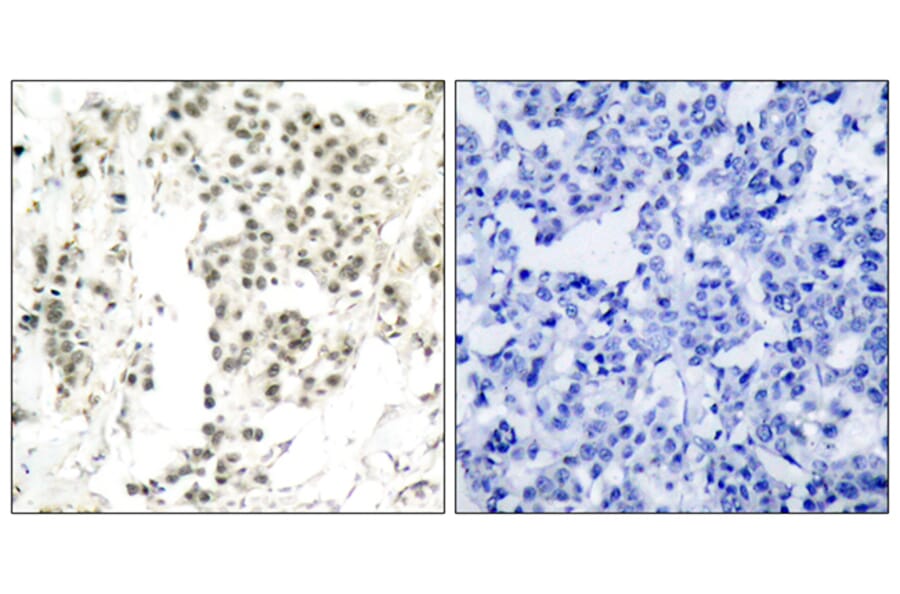 Immunohistochemistry - Anti-Chk1 (phospho Ser345) Antibody (A7042) - Antibodies.com