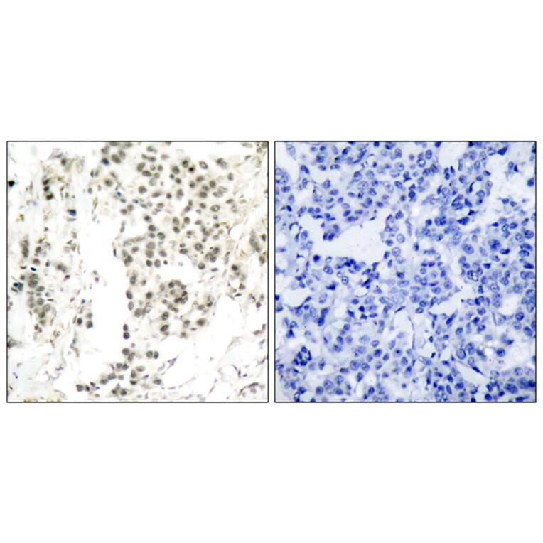 Immunohistochemistry - Anti-Chk1 (phospho Ser345) Antibody (A7042) - Antibodies.com