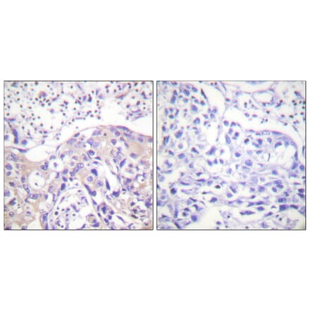 Immunohistochemistry - Anti-ADD1 (phospho Thr445) Antibody (A0451) - Antibodies.com