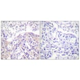 Immunohistochemistry - Anti-ADD1 (phospho Thr445) Antibody (A0451) - Antibodies.com