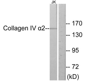 Western Blot - Anti-Collagen IV alpha2 Antibody (C12196) - Antibodies.com