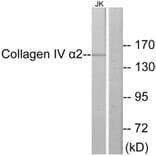 Western Blot - Anti-Collagen IV alpha2 Antibody (C12196) - Antibodies.com