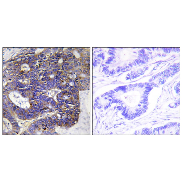 Immunohistochemistry - Anti-Collagen IV alpha2 Antibody (C12196) - Antibodies.com