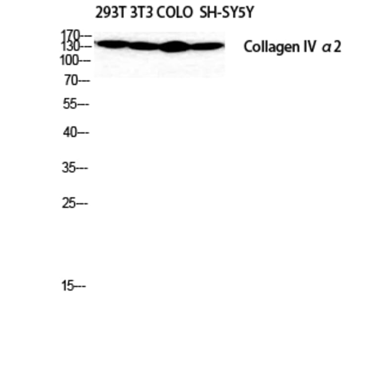 Western Blot - Anti-Collagen IV alpha2 Antibody (C12196) - Antibodies.com