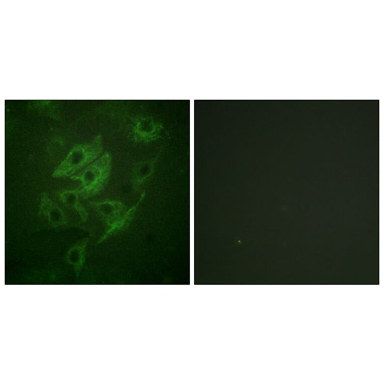Immunofluorescence - Anti-NMDAR2A + NMDAR2B Antibody (B0959) - Antibodies.com