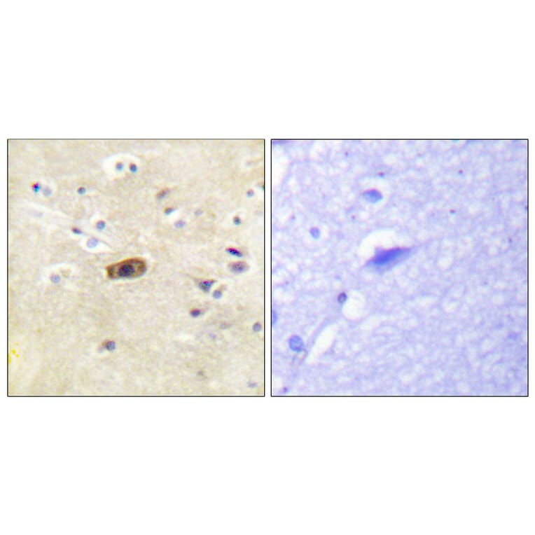 Immunohistochemistry - Anti-NMDAR2A + NMDAR2B Antibody (B0959) - Antibodies.com