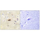 Immunohistochemistry - Anti-NMDAR2A + NMDAR2B Antibody (B0959) - Antibodies.com