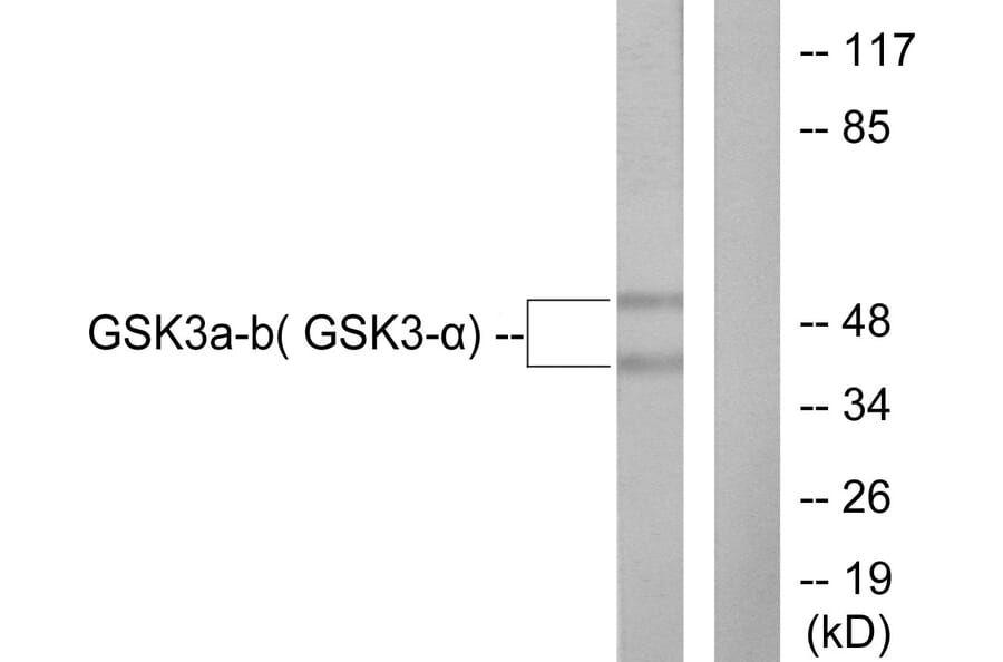 Western Blot - Anti-GSK3 alpha + beta Antibody (B0012) - Antibodies.com