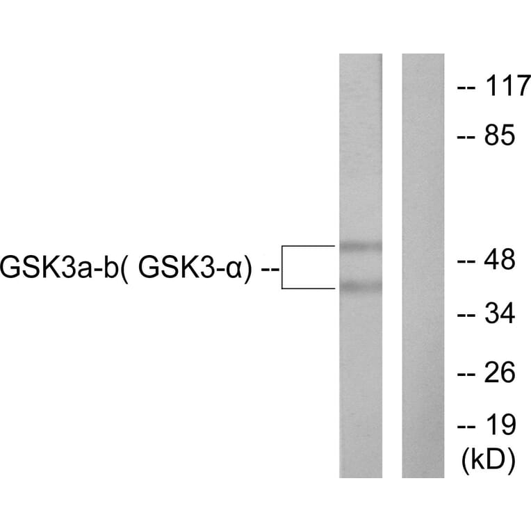 Western Blot - Anti-GSK3 alpha + beta Antibody (B0012) - Antibodies.com