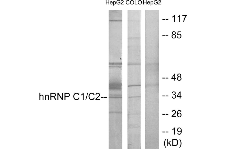 Western Blot - Anti-hnRNP C1 + C2 Antibody (C10296) - Antibodies.com