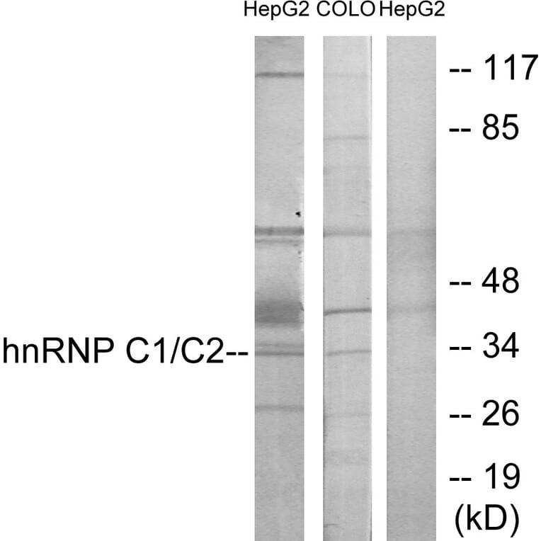 Western Blot - Anti-hnRNP C1 + C2 Antibody (C10296) - Antibodies.com