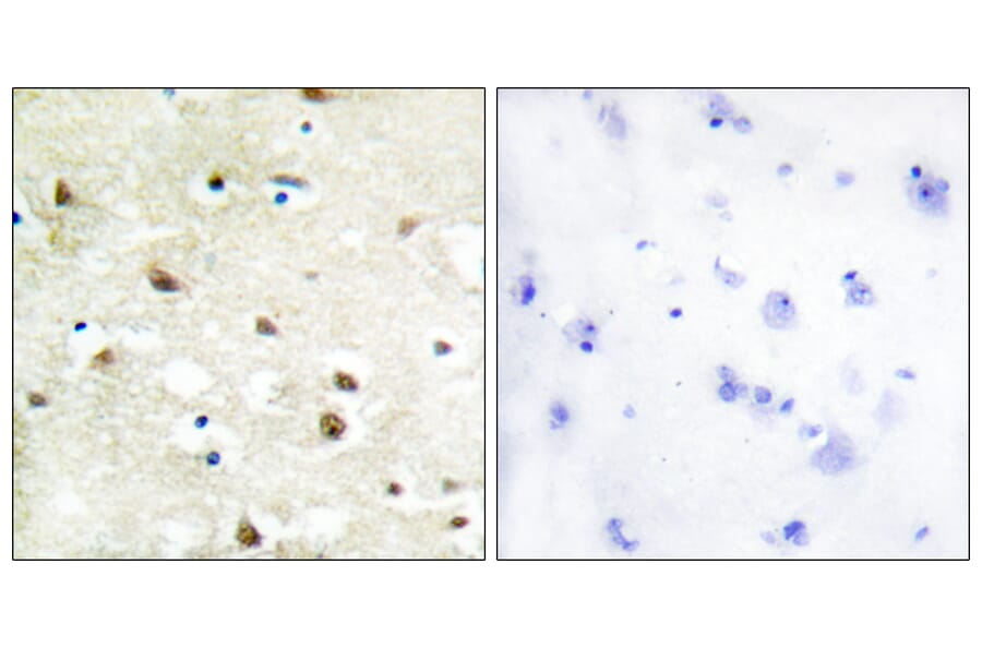 Immunohistochemistry - Anti-hnRNP C1 + C2 Antibody (C10296) - Antibodies.com