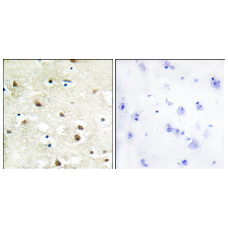 Immunohistochemistry - Anti-hnRNP C1 + C2 Antibody (C10296) - Antibodies.com