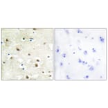 Immunohistochemistry - Anti-hnRNP C1 + C2 Antibody (C10296) - Antibodies.com