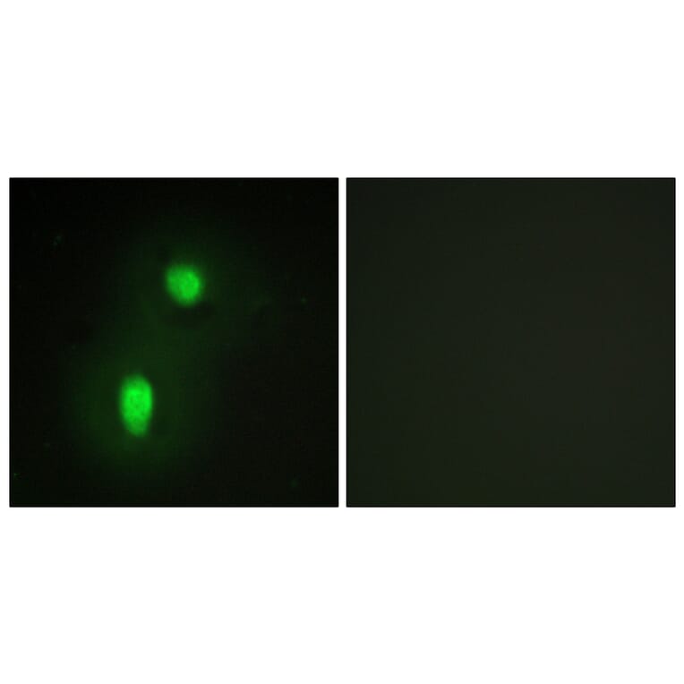 Immunofluorescence - Anti-hnRNP C1 + C2 Antibody (C10296) - Antibodies.com