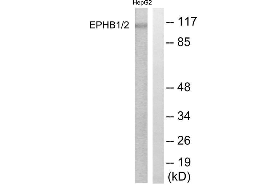Western Blot - Anti-EPHB1 + EPHB2 Antibody (B0915) - Antibodies.com