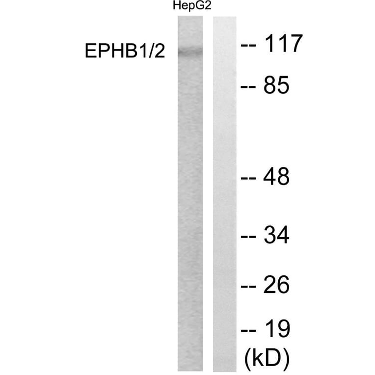Western Blot - Anti-EPHB1 + EPHB2 Antibody (B0915) - Antibodies.com