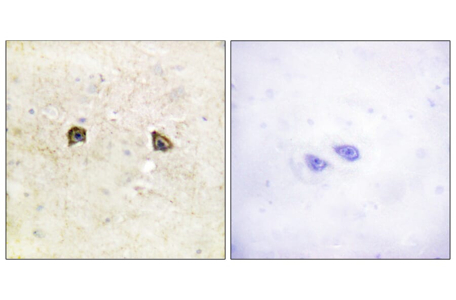 Immunohistochemistry - Anti-EPHB1 + EPHB2 Antibody (B0915) - Antibodies.com
