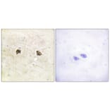 Immunohistochemistry - Anti-EPHB1 + EPHB2 Antibody (B0915) - Antibodies.com