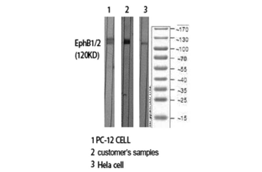 Western Blot - Anti-EPHB1 + EPHB2 Antibody (B0915) - Antibodies.com