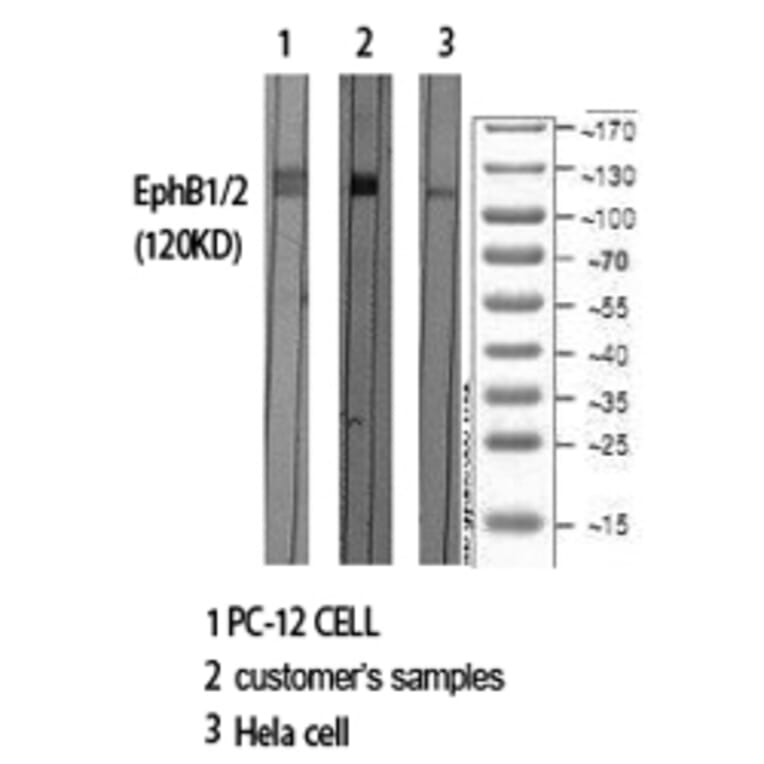 Western Blot - Anti-EPHB1 + EPHB2 Antibody (B0915) - Antibodies.com