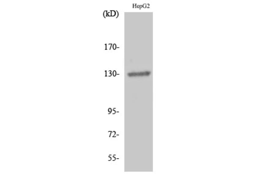 Western Blot - Anti-EPHB1 + EPHB2 Antibody (B0915) - Antibodies.com