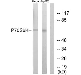 Western Blot - Anti-p70 S6 Kinase Antibody (B0532) - Antibodies.com