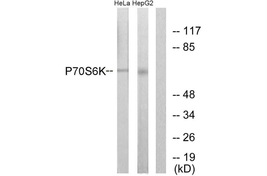 Western Blot - Anti-p70 S6 Kinase Antibody (B0532) - Antibodies.com
